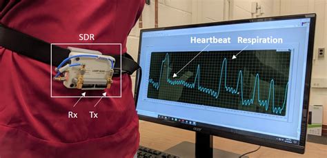 rf vital signal detection